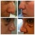 Befores and afters!
