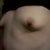 Pre-op 2-20-12