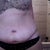 Day 5 and looking much better. Still pretty swollen.