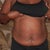 This is my before-- two days prior to my procedure, which is scheduled for 10/26/2012
Frontview