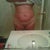 before my surgery1