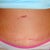 This is my scar at 8 weeks.