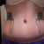 I am a little swollen in this one at 2 months out. I still have to watch the sodium levels to help the water retention some days. I'm using a silicone scar sheet.