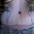 Also about 2 months out, give or take a week. Not swollen this day. My belly button is scarred badly and I'm just hoping it gets better.