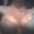 Four months post op with bra on