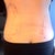 Back post surgery 12 hours