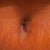 Belly button at 3 week. the pic don't do it justice. I'ts swollen but I have to get really close to see the incisions.