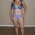PO Day 10 - first bikini picture in 37 years.  Still have 8 lbs of swelling I'm dealing with and lots of bruising, but all in all, I'm happy.