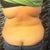 Back to show bra line area that will be lipo