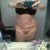 8 weeks post op