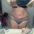 8 weeks post op scar starting to flatten out