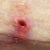 Spit a stitch :/