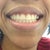 After 20 weeks/10 trays top and bottom.  What do you think??