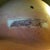 Right side incision