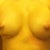 boobies are starting to even out. Post op day 6