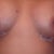 DAY 3:Does it look like it dropped a bit?