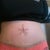 This morning woke up swollen :(