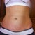 Pre-op Front View