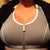 Few days post op (Danksin foam sports bra under $12 - Walmart) - 38D.