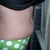 14 weeks 2 days PO