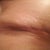 Left dog ear