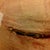 5 Week post op and incision issues