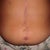 This is my scarred stomach from having too many operations the pictures dont make the scarring look too bad! but trust me they are!