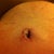 2+ weeks PO and my BB is still oozing goo.