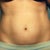 BEFORE:  front view