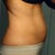 BEFORE:  side view