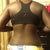 7 days post op back view