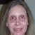 Yikes SunScreen on face looks ghost like, Flash makes eyes look red! Under eyes PINK 1 month not red, Skin Beautiful, Fat Fill wonderful!