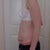 2 weeks after surgery - side.  Bad posture still, but the pooch is still in evidence