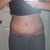 2 weeks post op in the evening after a day of shopping. Not looking bad :-)