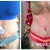 from 1 to 2 weeks PO. me likey!