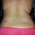 6 weeks P/O back