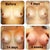 My right breast has the 2 freckles on it close to the armpit.  This is the smaller breast & my dominant side.  The teardrop shape implant is now visible at 4weeks.