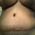 14 days post still swollen