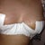 Day 8 post operation- new dressings. Left breast less swollen and breasts are taking more shape