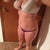 Before going into surgery - 170 pounds