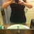 1 week post Op.