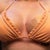 Day 10 tape to lt breast PS placed for better result after swelling