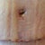 Scary close up of ZOMBIE belly button and incision Day 12 post op!  The crazy scary ridges are from the compression garment and swelling -- totally normal.  And both incision and button look BEAUTIFUL as far as I am concerned for Day 12 !