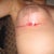 right side not doing so well