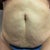 Tummy front before