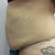 tummy side before