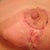 Worried black spot is pink