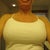Two Weeks Post Op