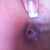 what is left of my belly button