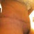 look how light the scar is in the first month